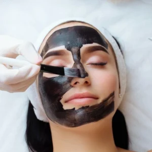 Carbon Laser Facial treatment at Vina Beauty Spa