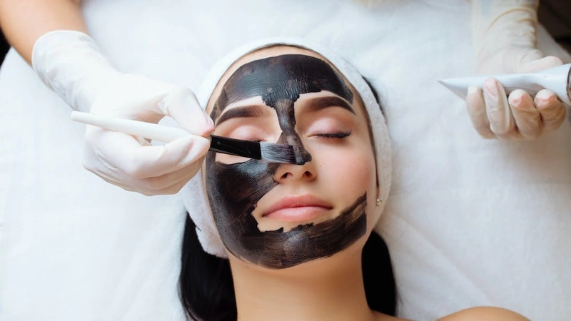 Carbon Laser Facial treatment at Vina Beauty Spa