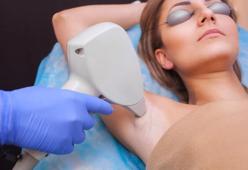 Laser Hair Removal treatment at Vina Beauty Spa