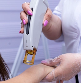 Laser Vein Removal treatment at Vina Beauty Spa