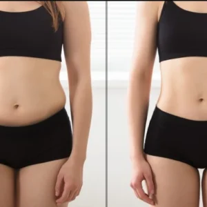 Non-Invasive Lipo Laser treatment at Vina Beauty Spa