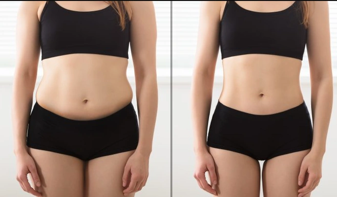 Non-Invasive Lipo Laser treatment at Vina Beauty Spa